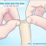 ?‍⚕️ 5+ Địa Chỉ Cắt Bao Quy Đầu Tốt HCM Nên Tham Khảo