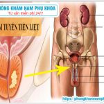 ?‍⚕️ Viêm Tuyến Tiền Liệt Và Những Hậu Quả Nghiêm Trọng