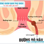 ?‍⚕️ Chi Phí Phẫu Thuật Chữa Rò Hậu Môn Hiện Nay Khoảng Bao Nhiêu