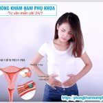 ?‍⚕️ Dấu Hiệu Nhận Biết Tình Trạng Viêm Phần Phụ Ở Nữ Giới