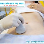 ?‍⚕️ Địa Chỉ Điều Trị Đa Nang Buồng Trứng Sau Bệnh Viện Từ Dũ