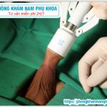 ⚕️ Địa Chỉ Cắt Bao Quy Đầu Ở Đồng Nai