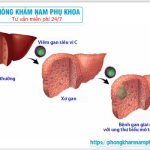 Nguyên Nhân Viêm Gan C Và Những Dấu Hiệu Nhận Biết