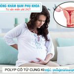 ⚕️ Bị Polyp Cổ Tử Cung Khi Mang Thai Có Nguy Hiểm Không