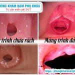 ?‍⚕️ Chi Phí Vá Màng Trinh Ở TPHCM Là Bao Nhiêu