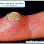 ?‍⚕️ Nhiễm Virus Papilloma Ở Người Như Thế Nào