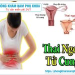 ?‍⚕️ Những Dấu Hiệu Thai Ngoài Tử Cung Bạn Cần Biết