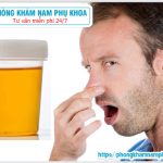 ⚕️ Nước Tiểu Có Mùi Hôi Là Bệnh Gì