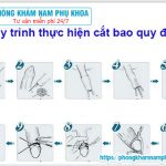 ⚕️ Quy Trình Cắt Bao Quy Đầu