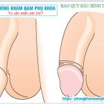 ⚕️ Cách Chữa Hẹp Bao Quy Đầu ở Người Lớn