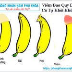 ⚕️ Viêm Bao Quy Đầu Có Tự Khỏi Không