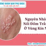 ?‍⚕️ Nguyên Nhân Nổi Đốm Trắng Ở Vùng Kín Nữ