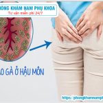 ?‍⚕️ Sùi Mào Gà ở Hậu Môn Có Ngứa Không