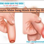 ⚕️ Nguyên Nhân Sưng Rãnh Bao Quy Đầu