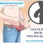 ⚕️ Cách Vệ Sinh Khi Bị Viêm Bao Quy Đầu