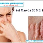 ?‍⚕️ Sùi Mào Gà Có Mùi Không