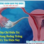 ?‍⚕️ Địa Chỉ Điều Trị U Nang Buồng Trứng Uy Tín Hiện Nay