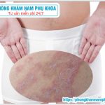 ⚕️ Nguyên Nhân Dẫn Đến Ngứa Dương Vật