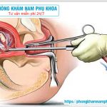 ?‍⚕️ Thường Xuyên Phá Thai Có Vô Sinh Không