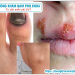 ?‍⚕️ Dấu Hiệu Nhận Biết Nhiễm HIV