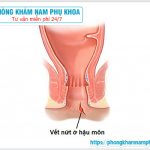 ?‍♀️ Bệnh Nứt Hậu Môn Và Cách Điều Trị