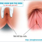 ?‍⚕️ Những Nguyên Nhân Gây Nứt Kẽ Hậu Môn Là Gì?