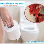 ⚕️ Nguyên Nhân Đi Cầu Ra Máu Tươi Nhiều