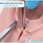 ?‍⚕️ Thẩm Mỹ Vùng Kín Bệnh Viện Hùng Vương