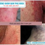 ?‍⚕️??‍⚕️ Nấm Candida Ở Nam Giới Có Tự Khỏi Không