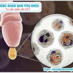 ⚕️ Thuốc Điều Trị Nấm Candida Ở Nam Giới