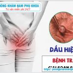 ?‍⚕️??‍⚕️ Dấu Hiệu Bệnh Trĩ Giai Đoạn Đầu Là Gì?