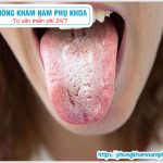 ⚕️ Chữa Nhiễm Nấm Candida Miệng – Họng Như Thế Nào?