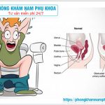 ⚕️ Đại Tiện Ra Máu Là Triệu Chứng Của Bệnh Gì?