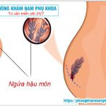 ⚕️ Cách Chữa Ngứa Hậu Môn Vào Ban Đêm