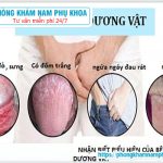 ⚕️ Cách Trị Nấm Candida Ở Nam Giới