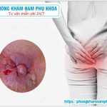 ⚕️ Cục Thịt Thừa Ở Hậu Môn Khi Mang Thai Là Dấu Hiệu Bị Gì?