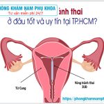 ⚕️ TOP 3 Những Địa Chỉ Đặt Vòng Tránh Thai Uy Tín