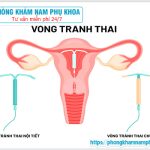 ⚕️ Chi Phí Đặt Vòng Tránh Thai Ở Bệnh Viện Bao Nhiêu Tiền