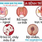 ⚕️ Bệnh Trĩ Nội Có Nguy Hiểm Không?