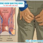 ⚕️ Nguyên Nhân Bị Lòi Dom