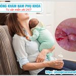 ⚕️ Cách Chữa Lòi Dom Sau Sinh