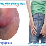 ⚕️ Sưng Hậu Môn Uống Thuốc Gì?