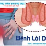 ⚕️ Bị Lòi Dom Có Nguy Hiểm Không?