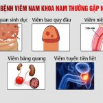 Khám Nam Khoa Là Khám Những Gì? Chi Phí Khám Bao Nhiêu?