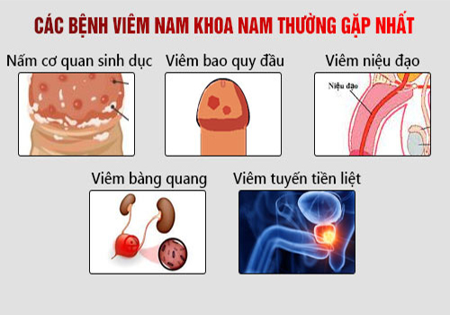 Khám nam khoa là khám những gì?