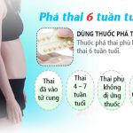 Chi Phí Phá Thai Bằng Thuốc Là Bao Nhiêu?