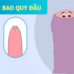 Dấu Hiệu Dài Bao Quy Đầu Ở Nam Giới