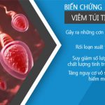 Rát Dương Vật Là Dấu Hiệu Bệnh Gì?