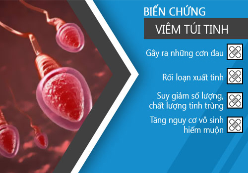 Dương vật bị rát là dấu hiệu bệnh gì?